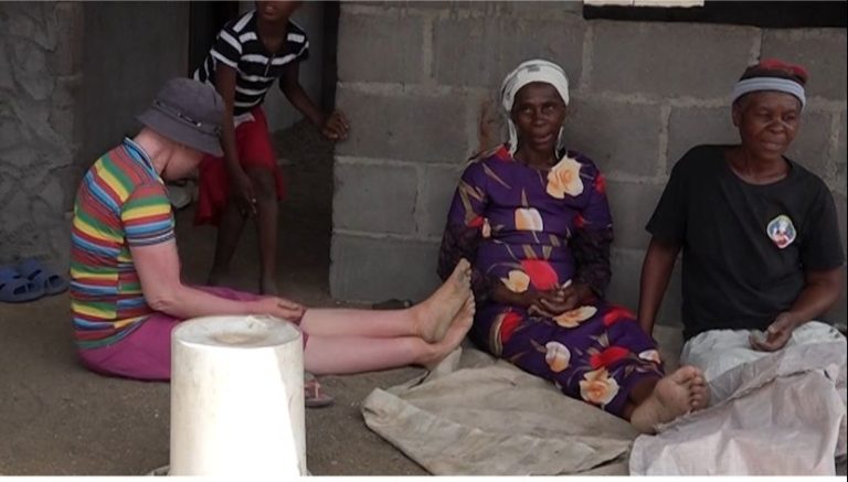 Call to protect and uphold rights for people with albinism